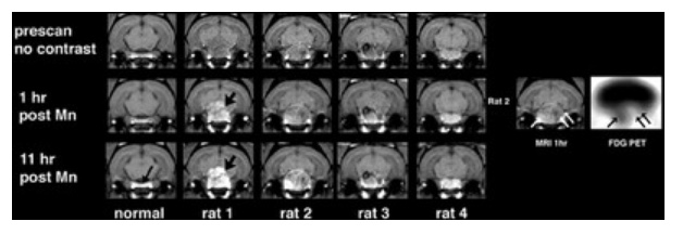 Translational BioImaging Core pic of scan