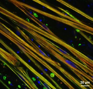 Alec Smith: The image is of stem cell-derived skeletal muscle stained with fluorescently-labelled antibodies